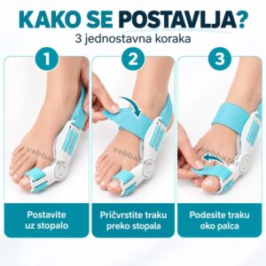 Postavljanje korektora za čukljeve u tri koraka